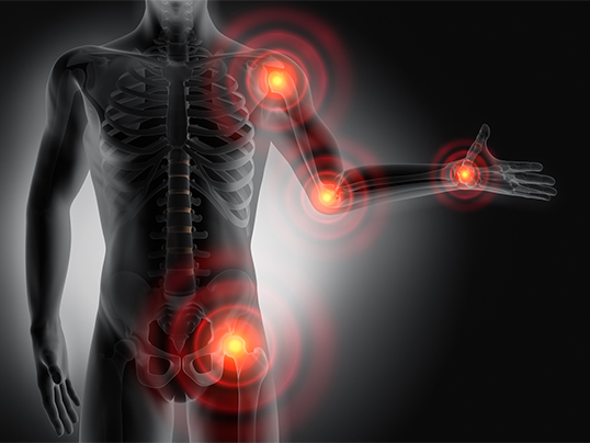 Fluoroquinolone Joint Pain